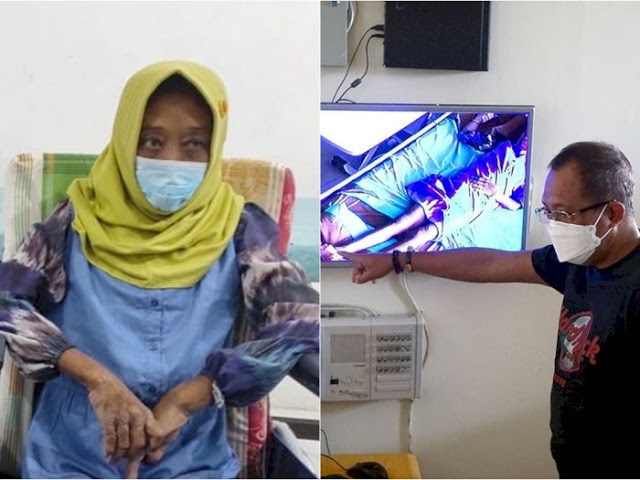 ART yang Disiksa Majikan Hingga Disuruh Makan Tahi Kucing Masih Dirawat di RS