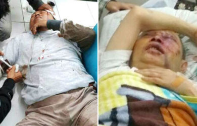 Mabes Polri Sebut Penganiayaan Ustaz di Bandung Diduga Bukan Gangguan Jiwa
