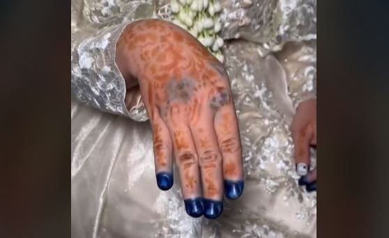 Tato Henna Gagal, Hasilnya Bikin Miris