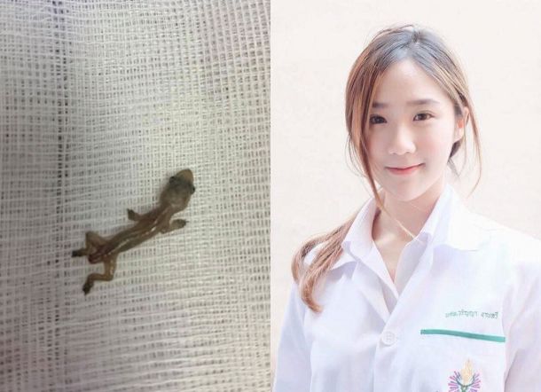 Pertama Kali Kerja, Dokter Cantik Ini Temukan Tokek di Telinga Pasien