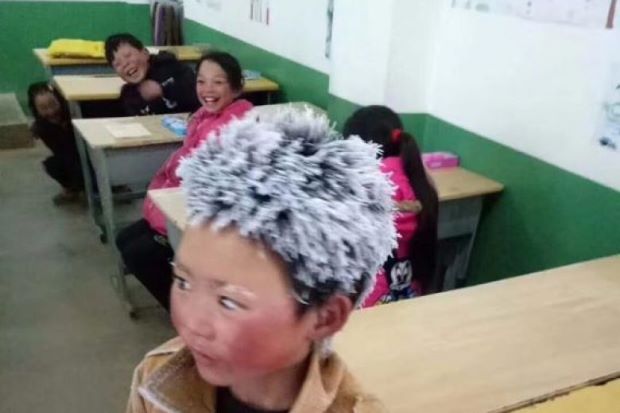 Bocah 'Berambut Es' China Dikeluarkan dari Sekolah yang Baru