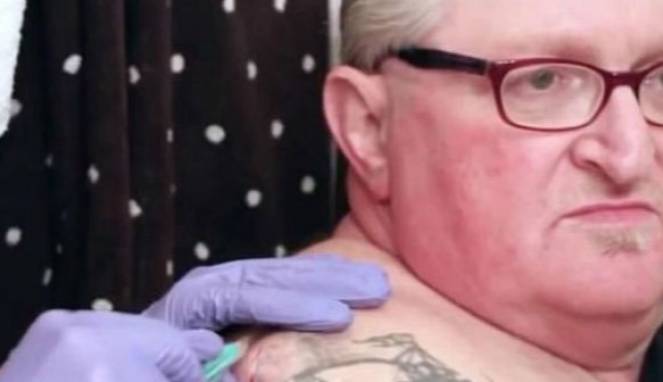 Benjolan Puluhan Tahun Dipecahkan, Ternyata Isinya Ini...