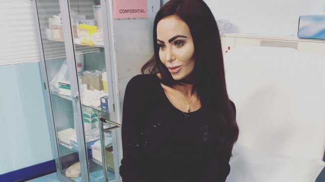 Wanita Ini Operasi Plastik demi Dapatkan Vagina Barbie