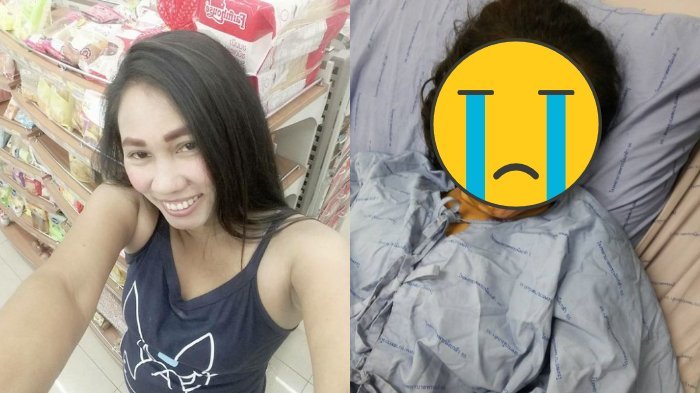 Rujuk Ditolak, Wanita Cantik ini Disiram Air Keras oleh Mantan Hingga Kondisinya Menyedihkan